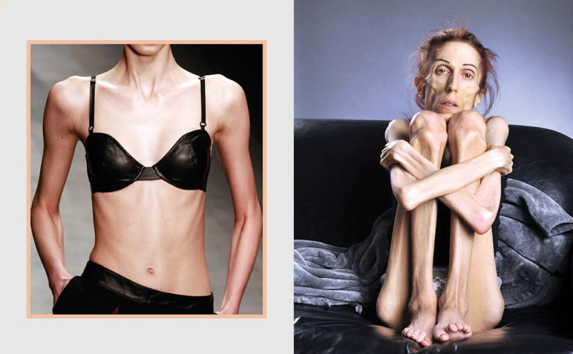 സൈസ് സീറോ അപകടം