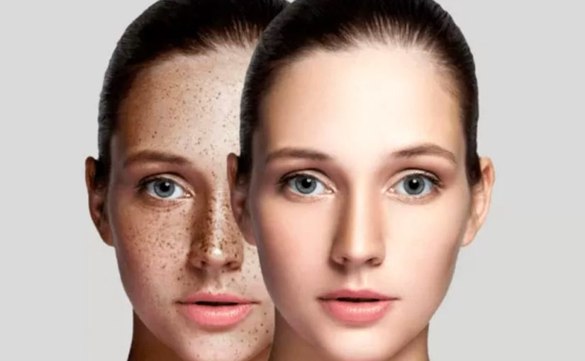 പാട് മാറ്റാൻ പാടൊന്നുമില്ല