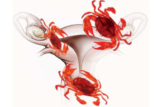 endometrial, uterus cancer