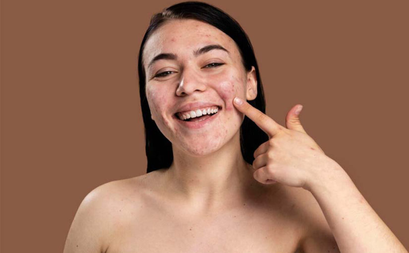 കണ്ണുകൾക്കടിയിൽ കറുത്ത പാടുണ്ടാകാൻ കാരണം?