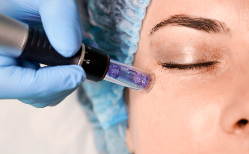 നോ നീഡിൽ മെസോതെറാപ്പി